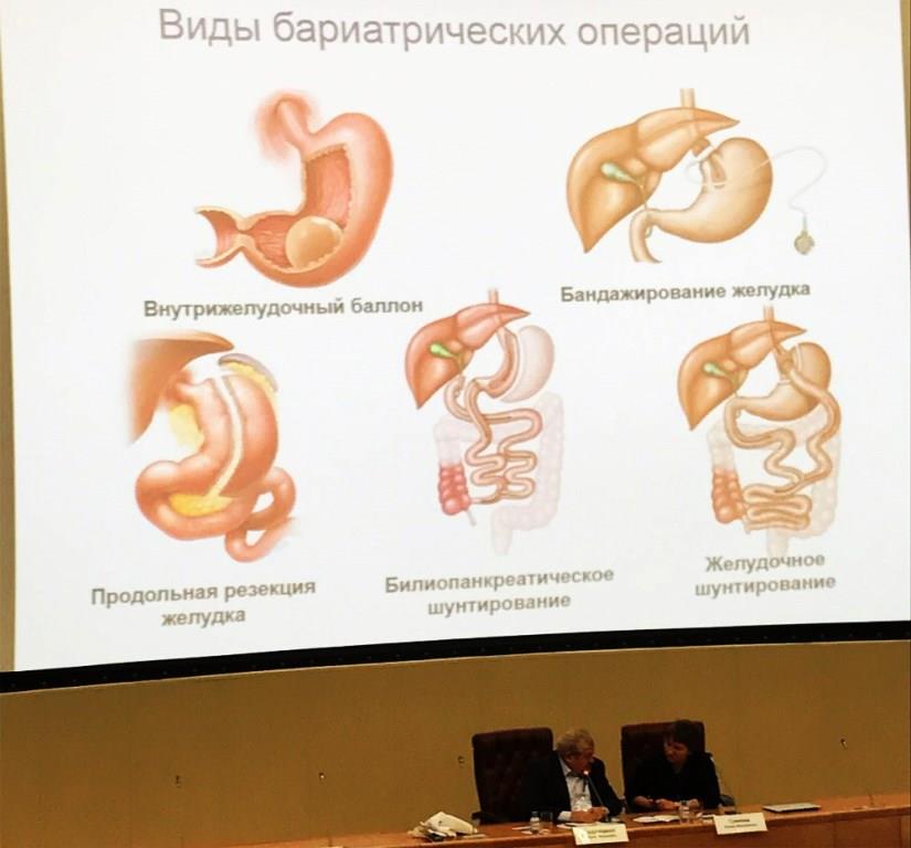 Конференция “Междисциплинарный подход к ведению пациентов с ожирением и сахарным диабетом 2 типа” forum v almazova 3