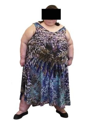 photo1